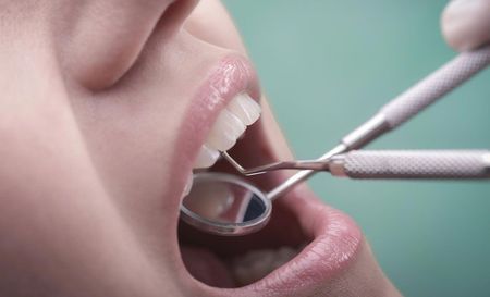 Bone Grafting
