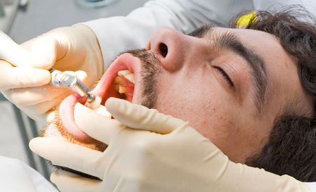Full Mouth Dental Implants

