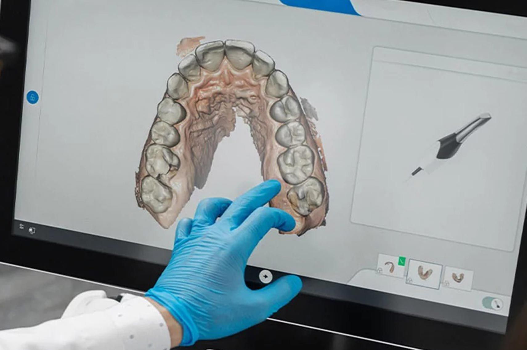 Learn More About Smile Preview Smile Preview