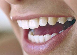 Close up of healthy teeth