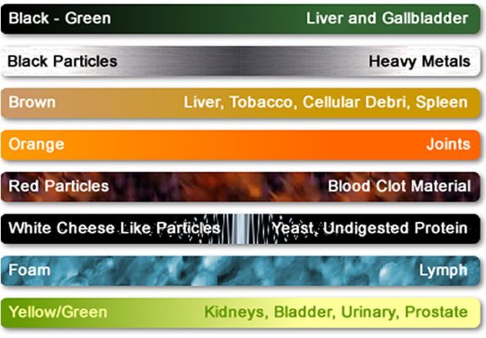 Diagram with color-coded bars indicating health concerns: liver, heavy metals, joints, blood clots, yeast, lymph, kidneys.