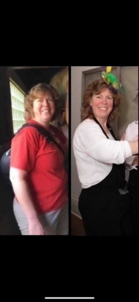 Two pictures of a woman before and after losing weight.