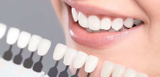 A close up of a woman's teeth with a tooth color chart