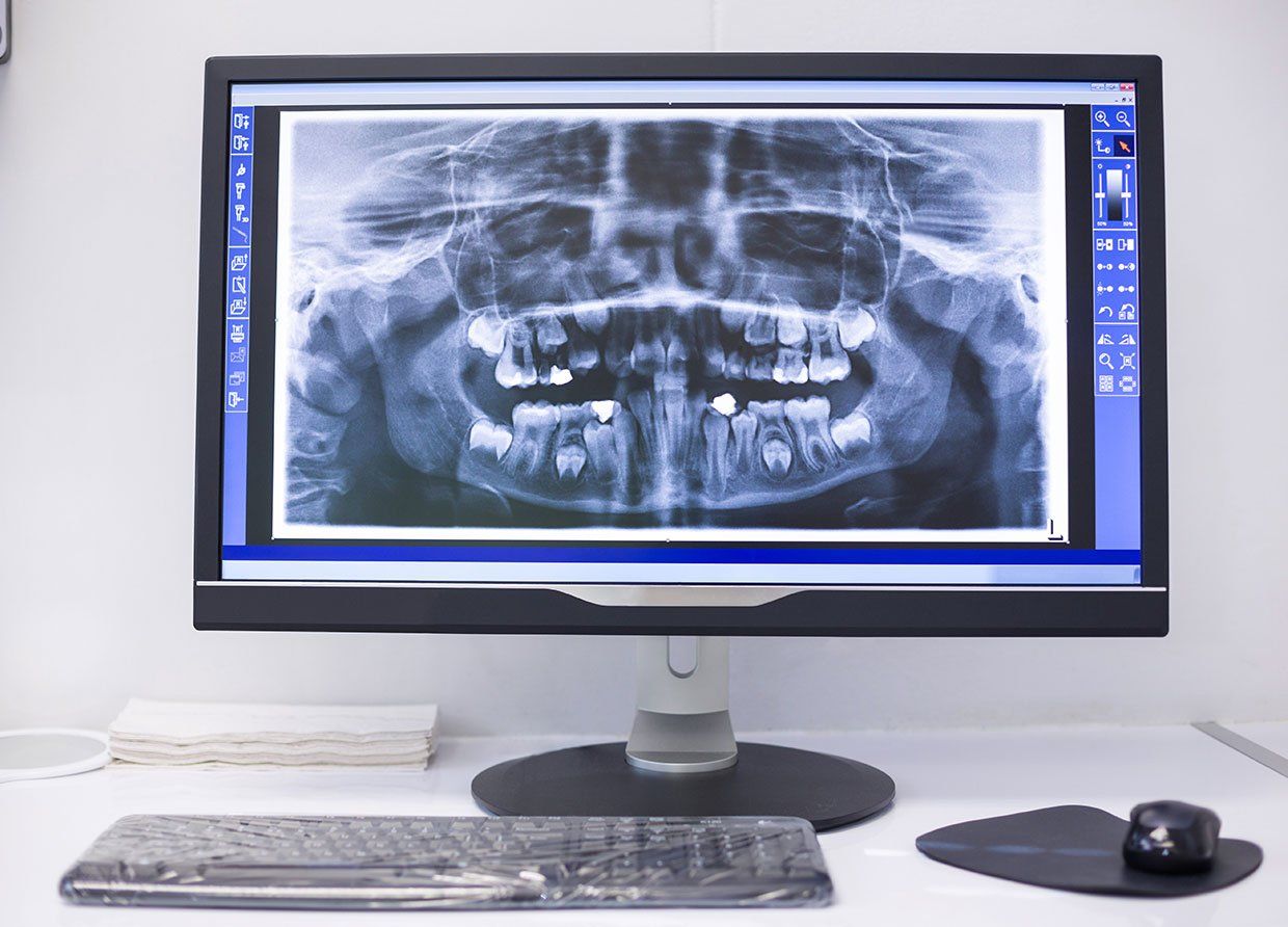 Dental x-ray