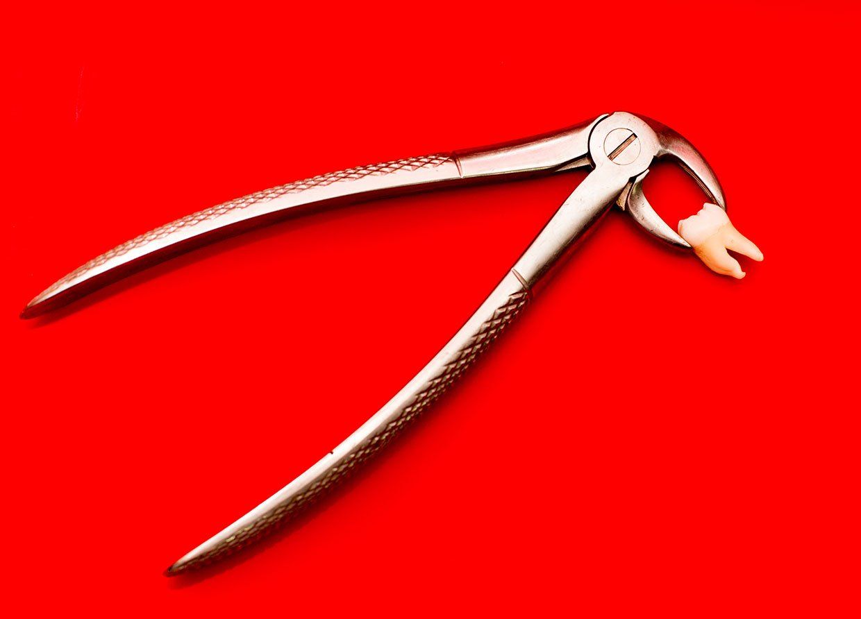Tooth extraction