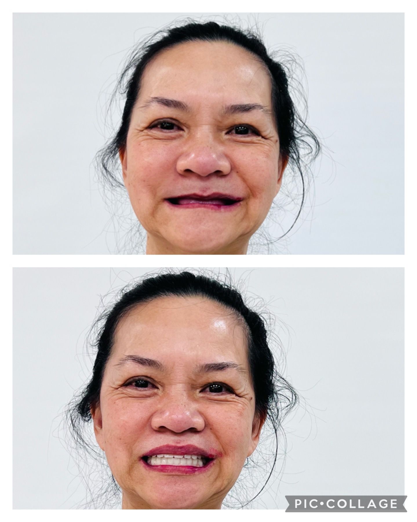 A woman with a missing tooth is smiling.