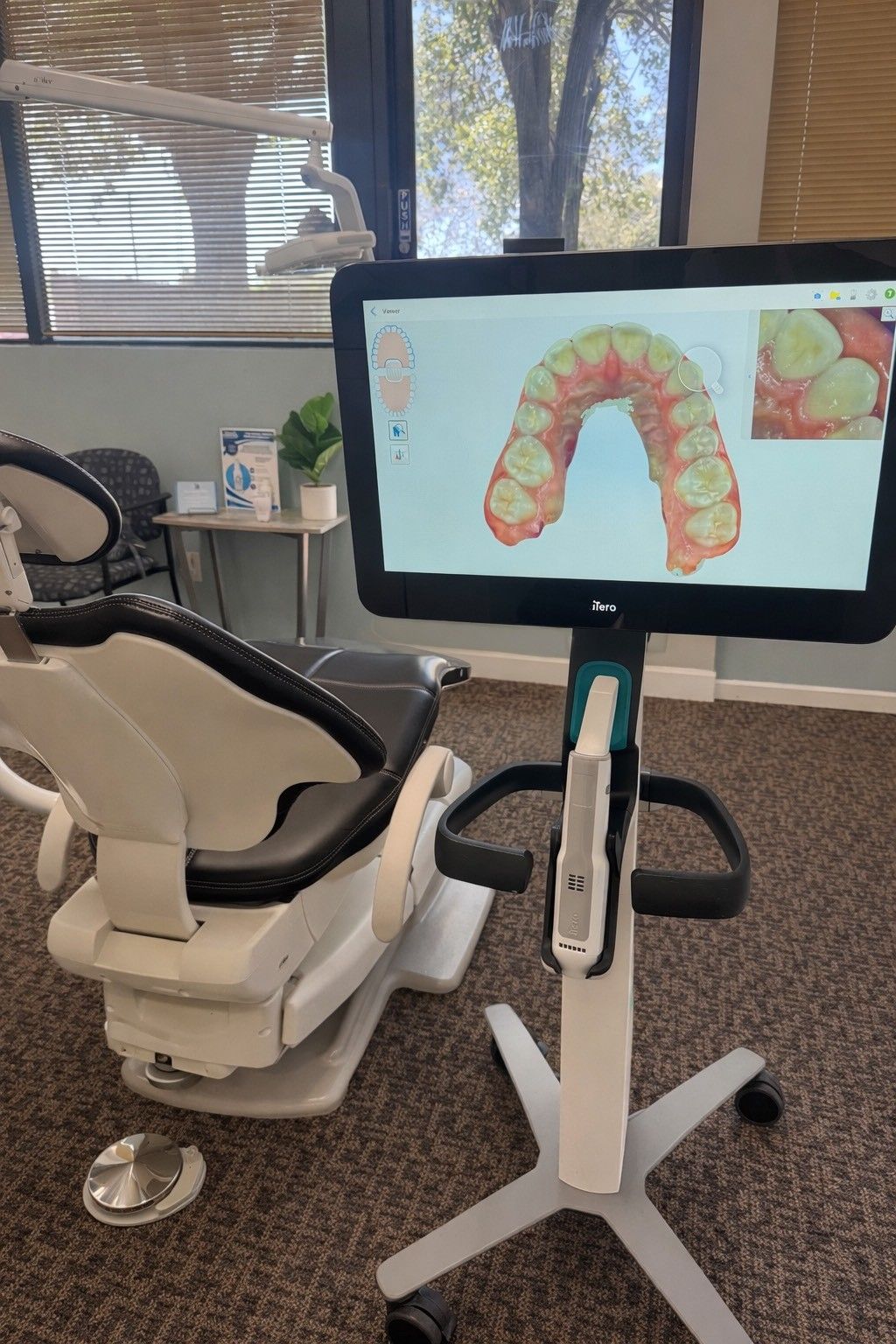 A dental exam room featuring a modern patient chair next to a digital scanner monitor displaying a 3D dental arch scan.