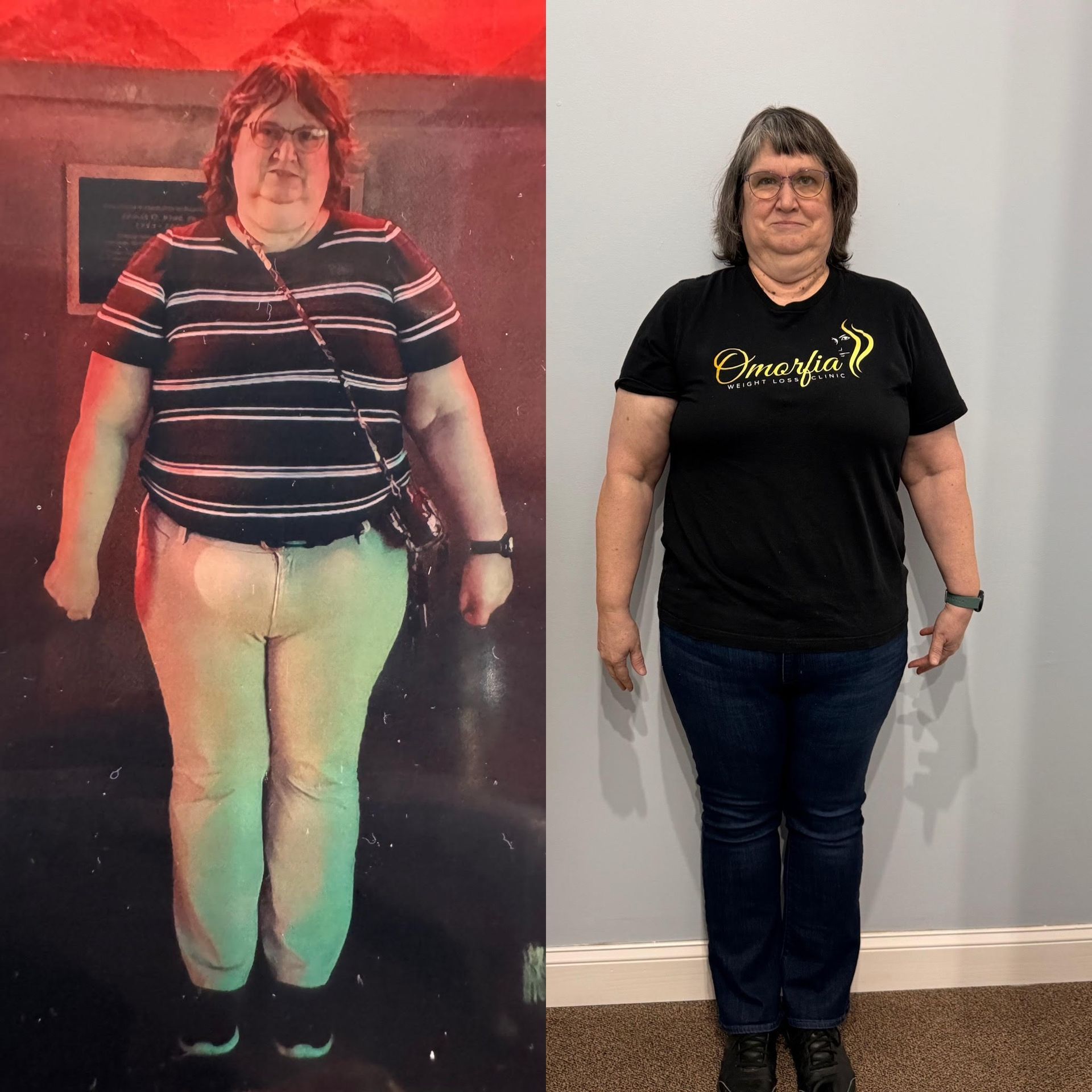 A woman is standing in front of a wall in a before and after photo.