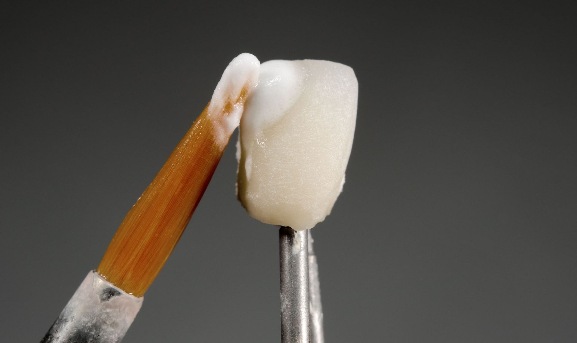 Dental Veneers
