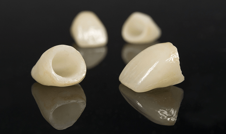 Dental Crowns