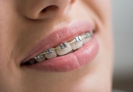 Hillstead Family Orthodontics
