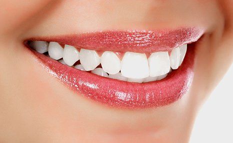 Woman's white smile
