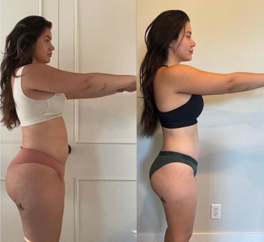 A before and after photo of a woman's weight loss.