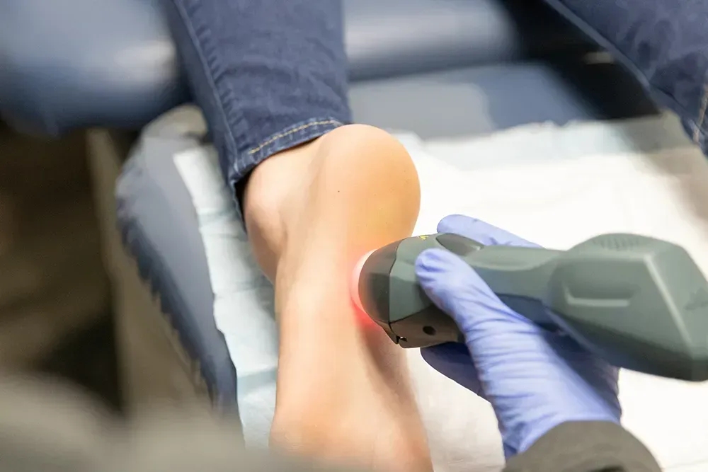 Foot receiving laser therapy treatment in a medical setting. A hand wearing a blue glove holds the device.