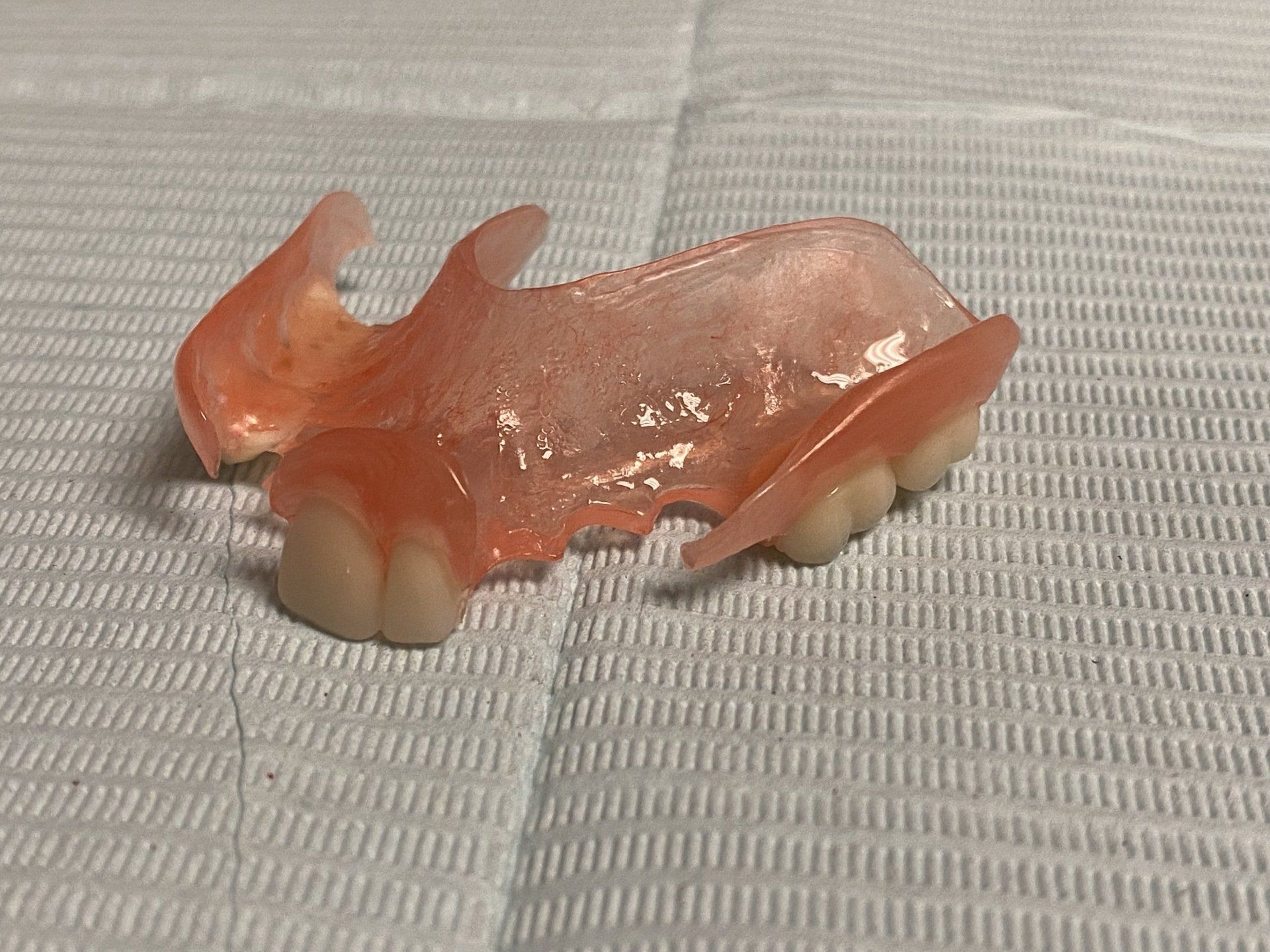 Duraflex flexible base partial denture to replace missing teeth