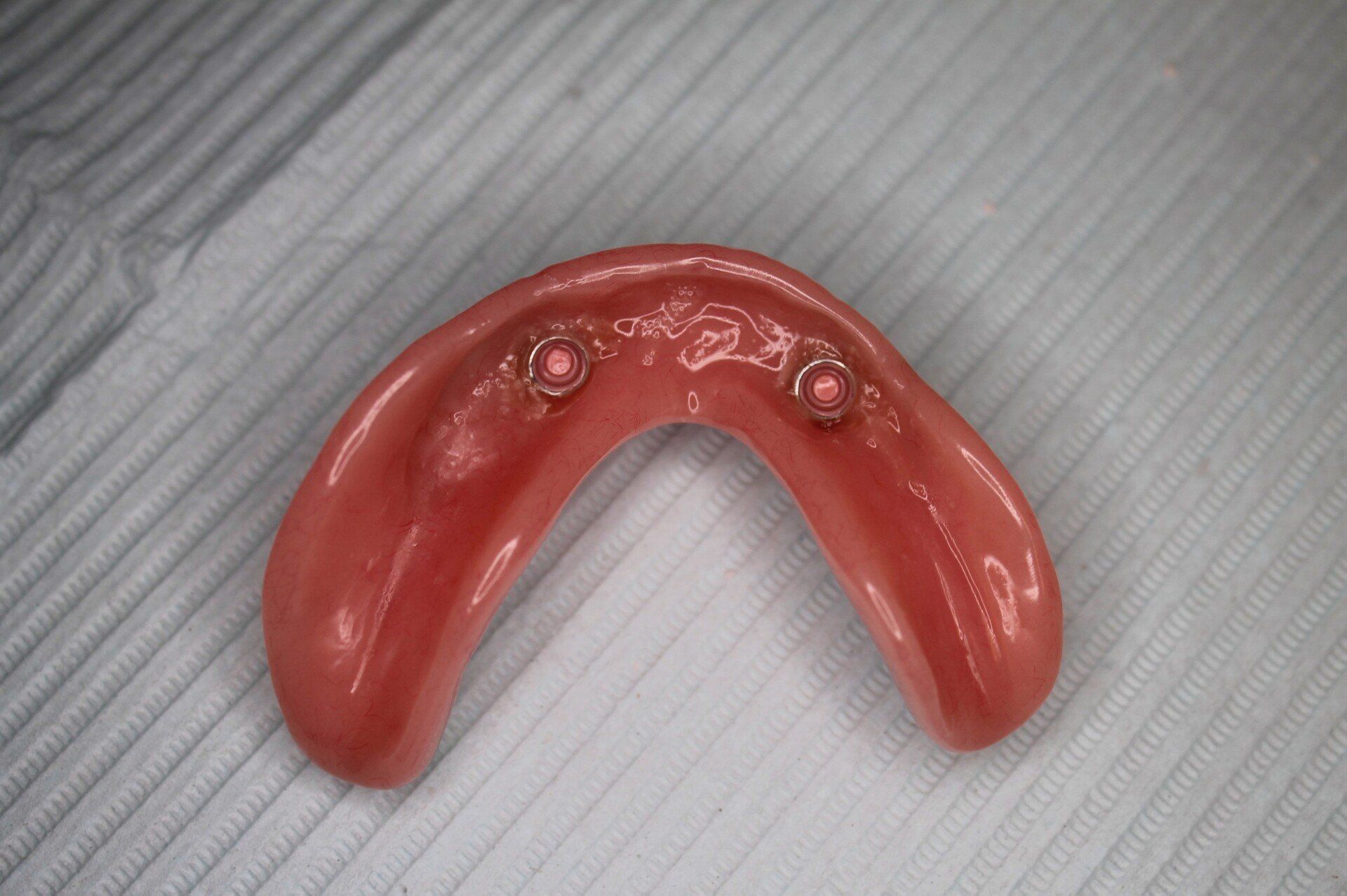 Lower complete denture with two overdenture Locator attachments to connect to implants.