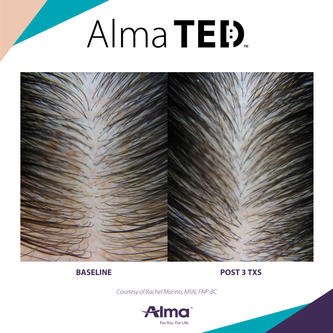 A before and after picture of a person 's hair