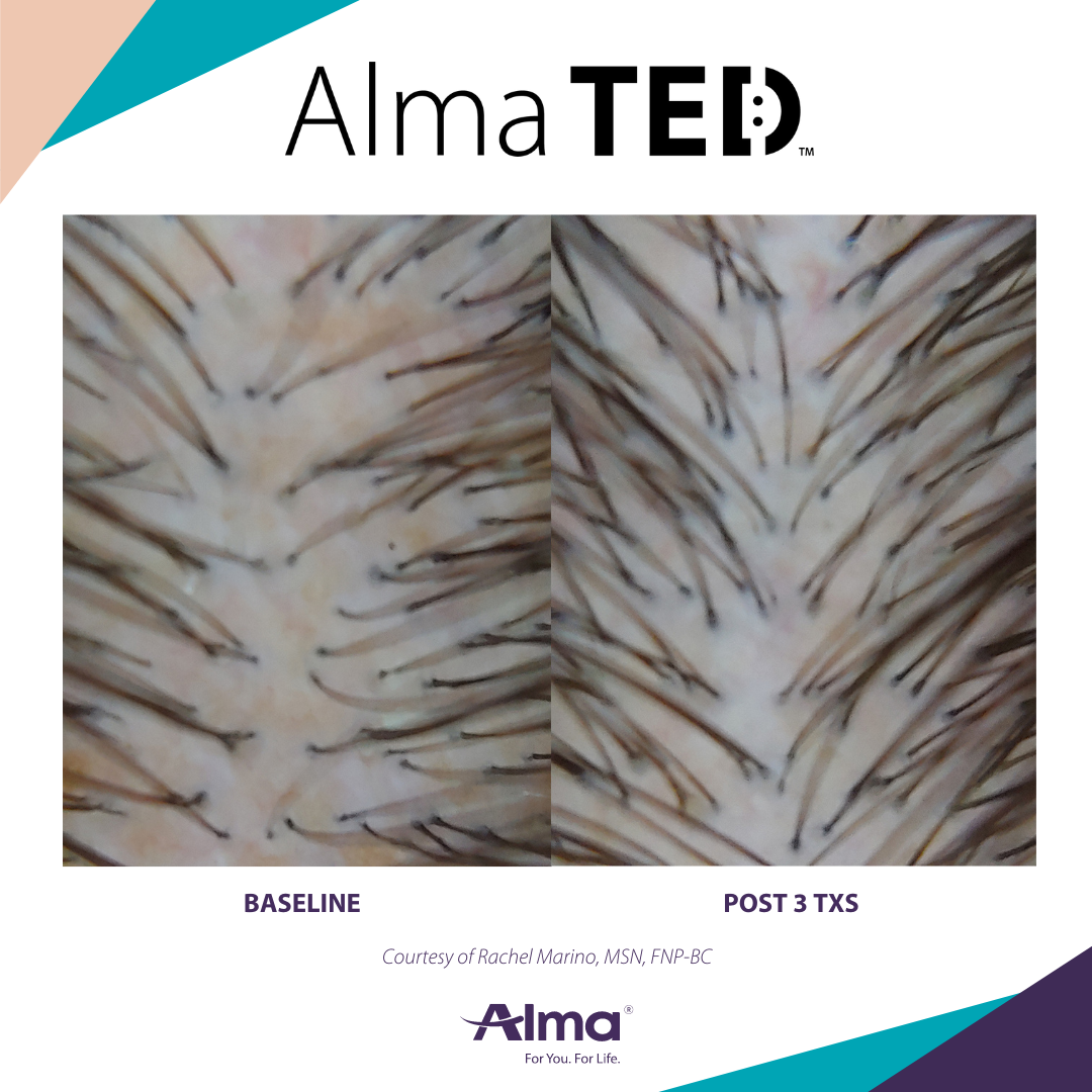 A before and after picture of a person 's hair