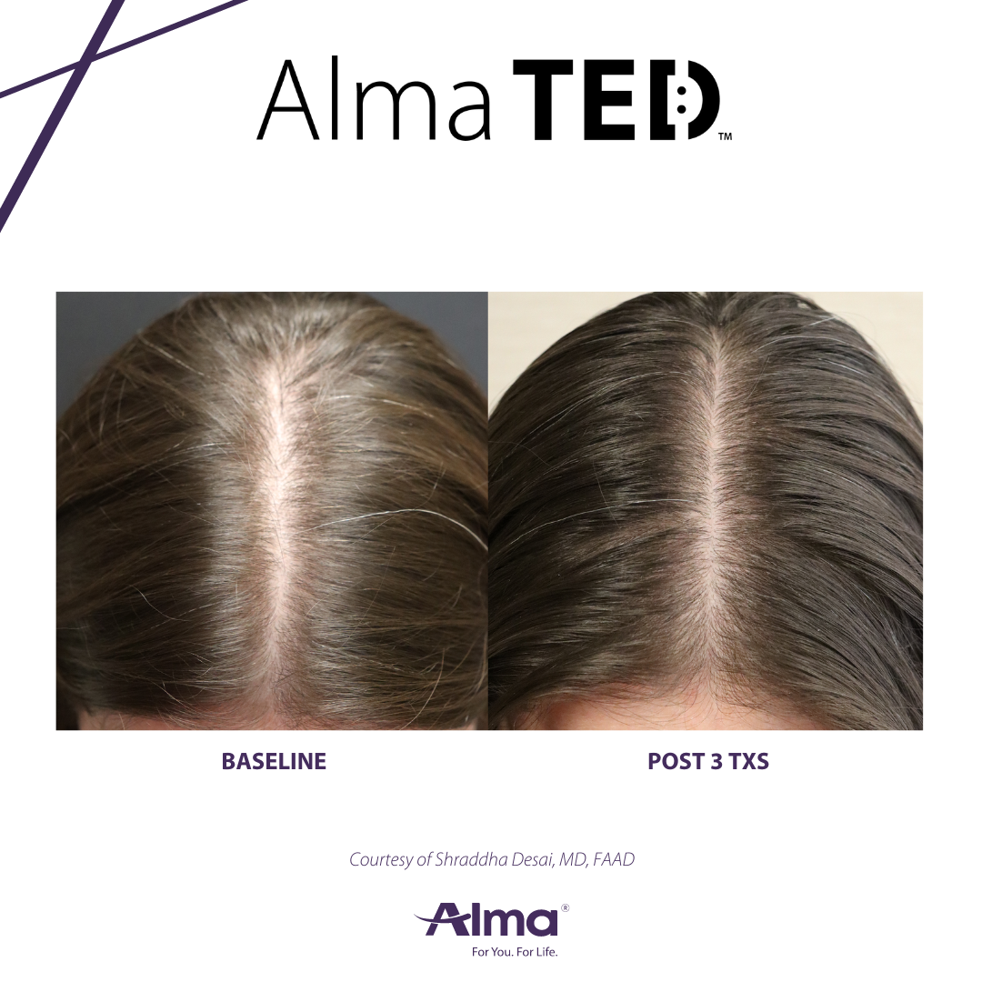 A before and after picture of a person 's hair