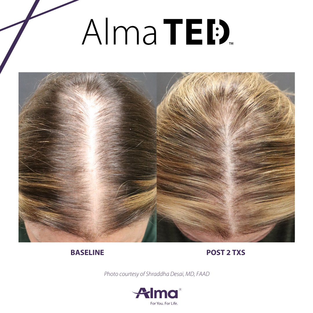 A before and after picture of a person 's hair