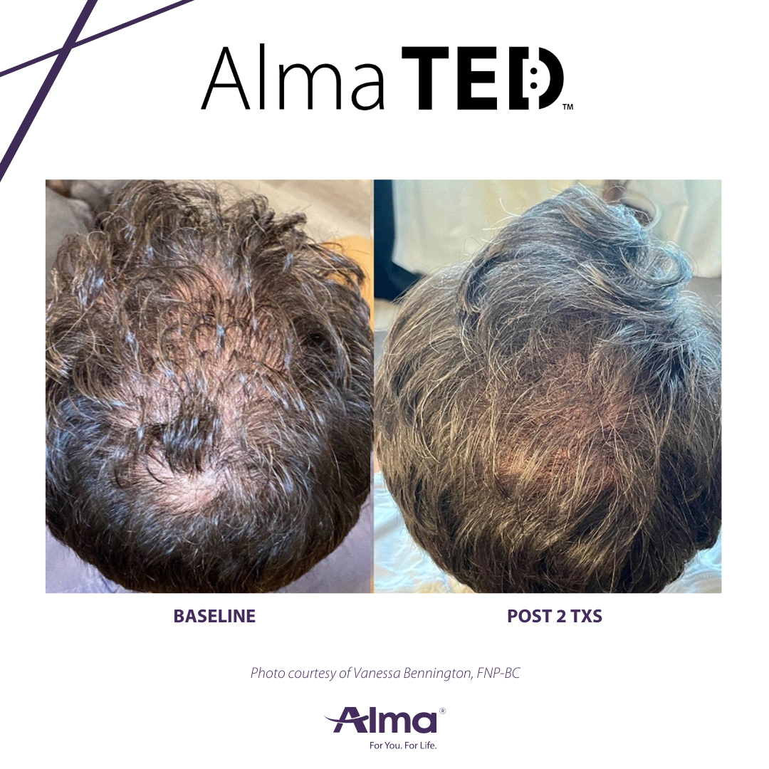 A before and after picture of a person 's hair