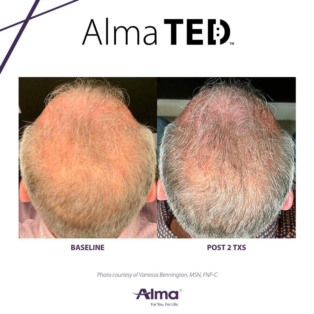 A before and after picture of a person 's hair