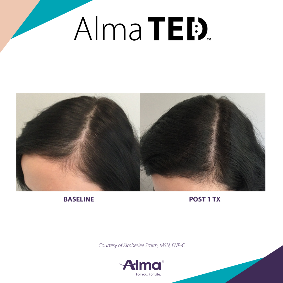 A before and after picture of a person 's hair