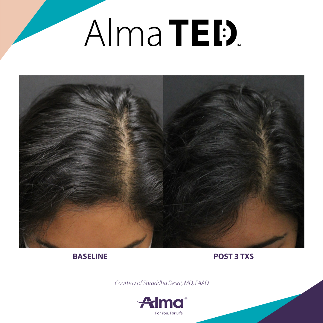 A before and after picture of a person 's hair