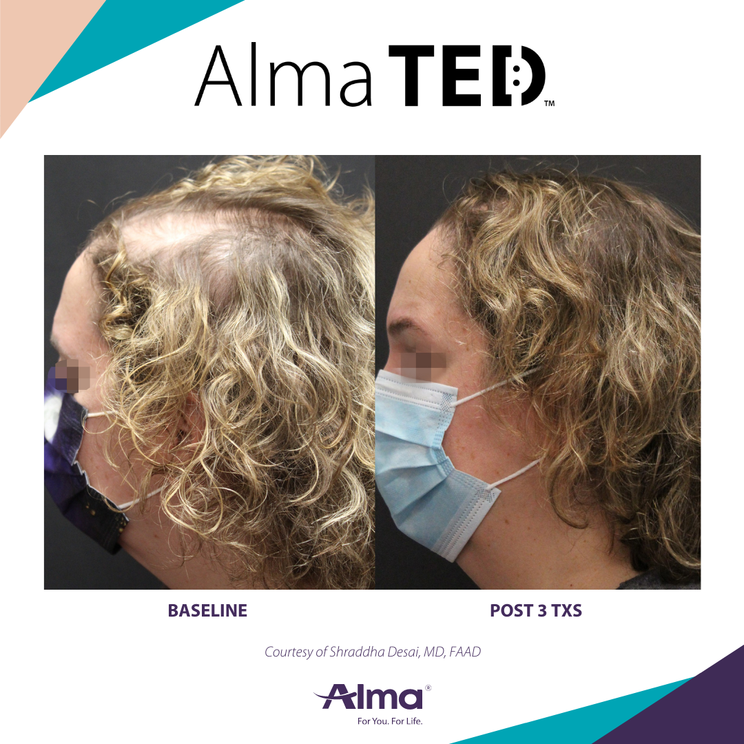 A before and after picture of a person 's hair