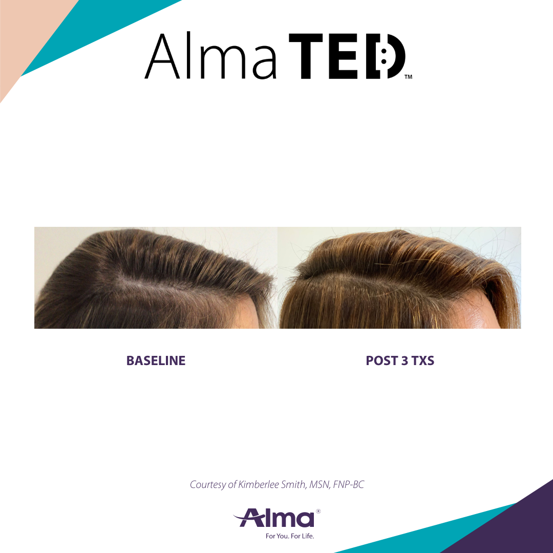 A before and after picture of a person 's hair