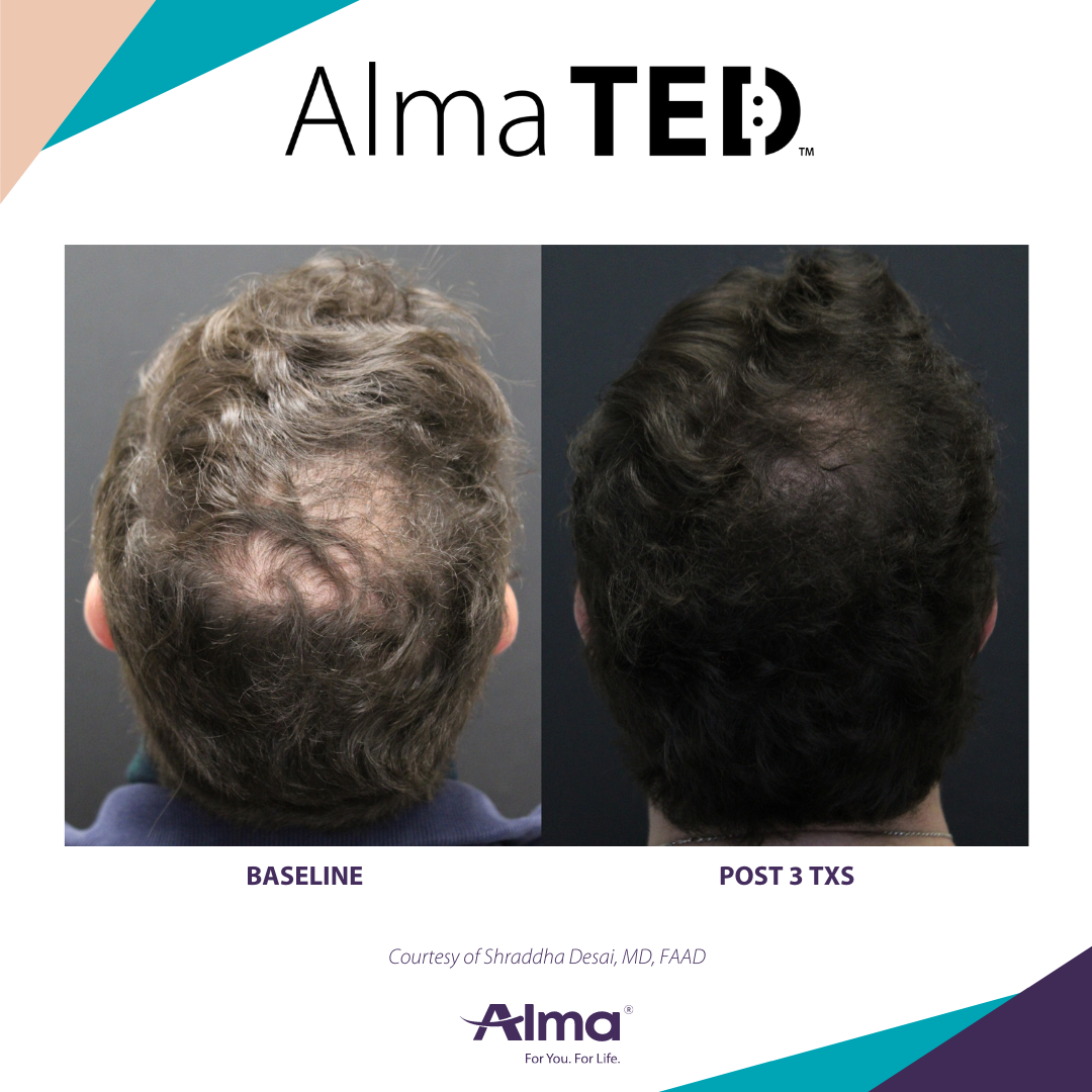 A before and after picture of a person 's hair