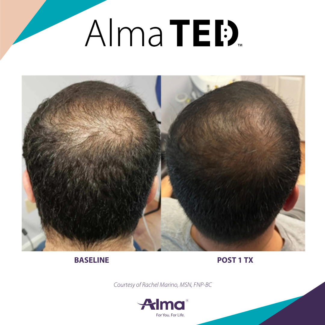 A before and after picture of a person 's hair
