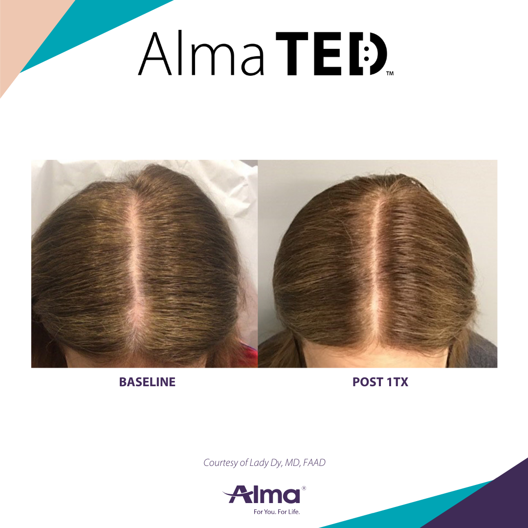 A before and after picture of a person 's hair