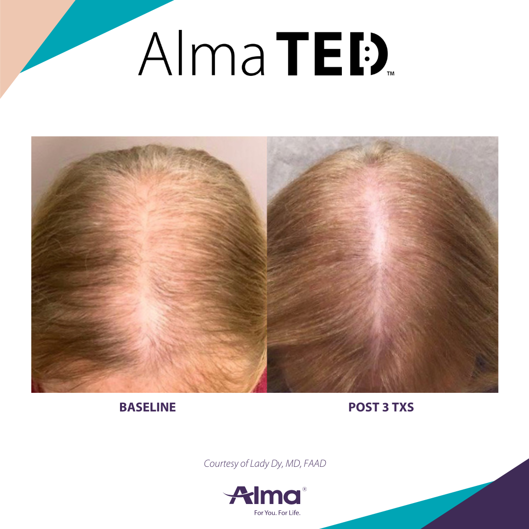 A before and after picture of a person 's hair