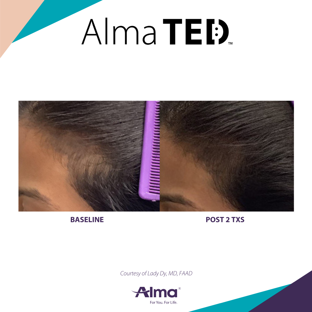 A before and after picture of a person 's hair