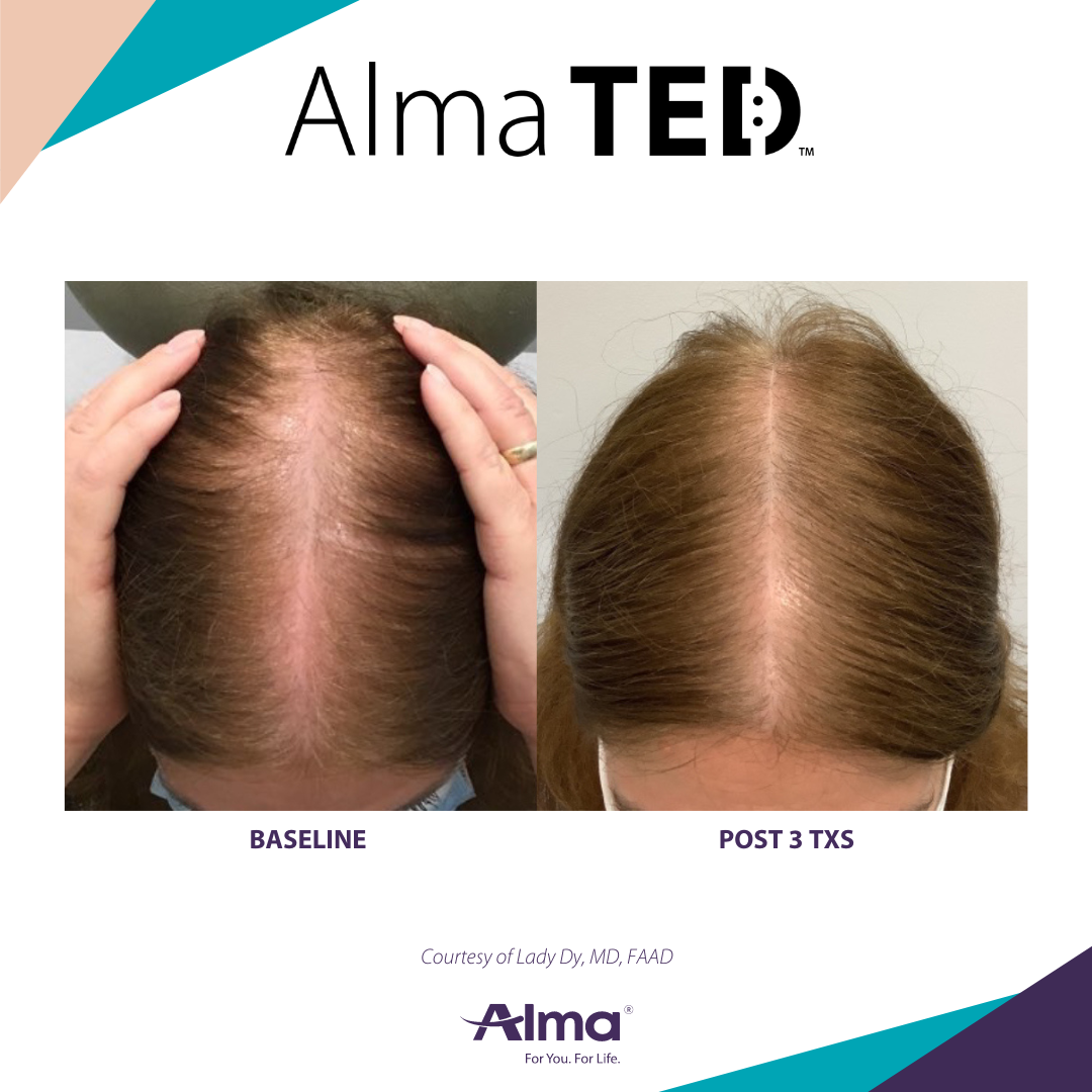 A before and after picture of a person 's hair