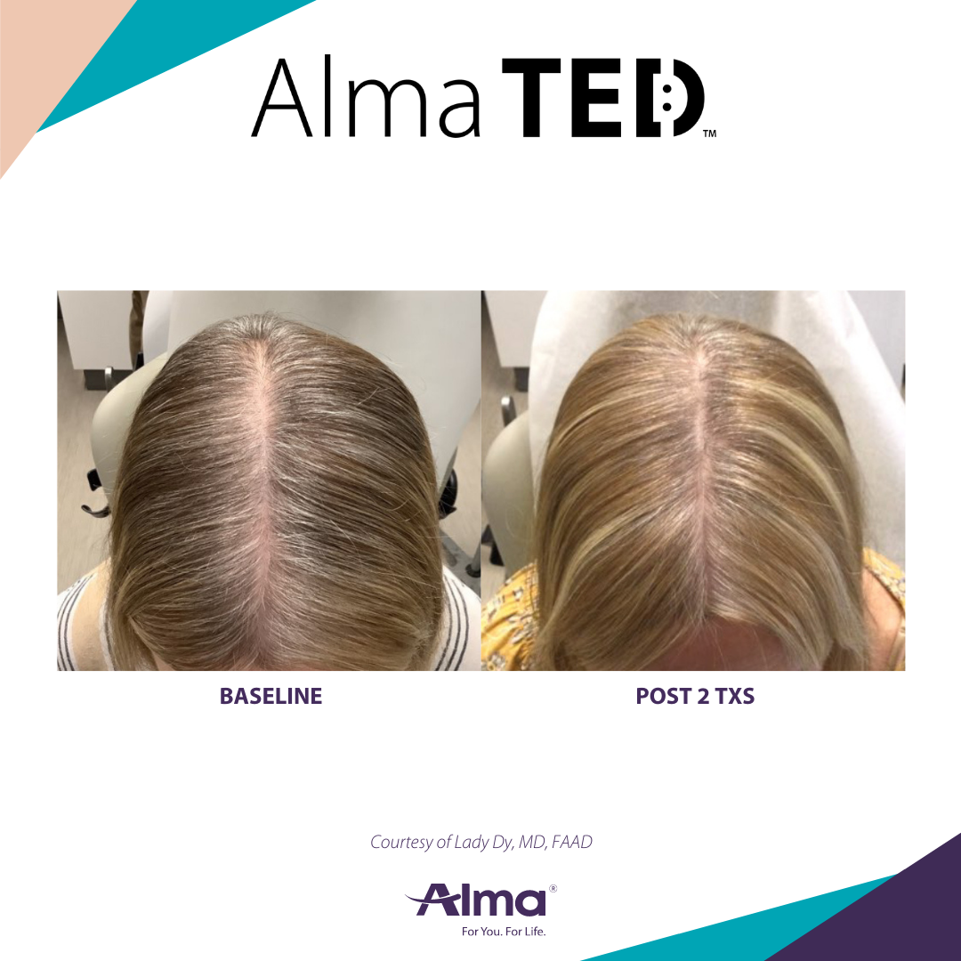 A before and after picture of a person 's hair