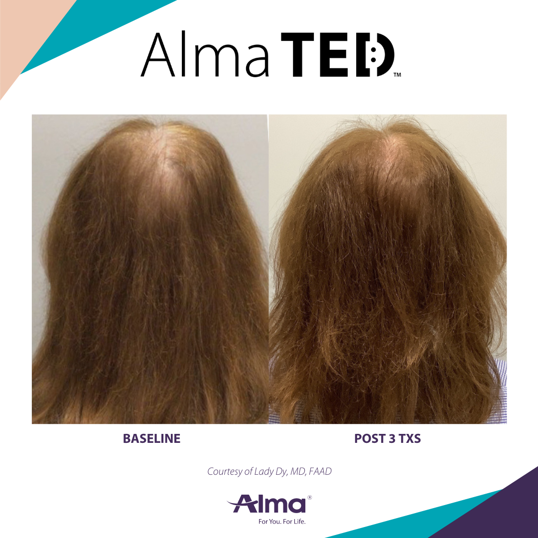 A before and after picture of a person 's hair