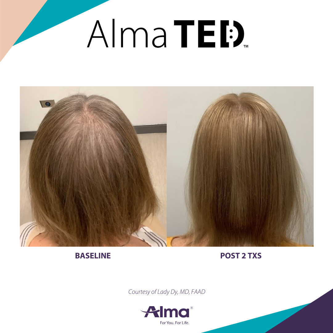 A before and after picture of a person 's hair