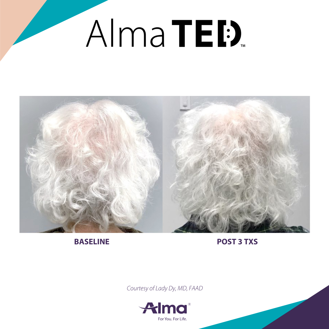 A before and after picture of a person 's hair