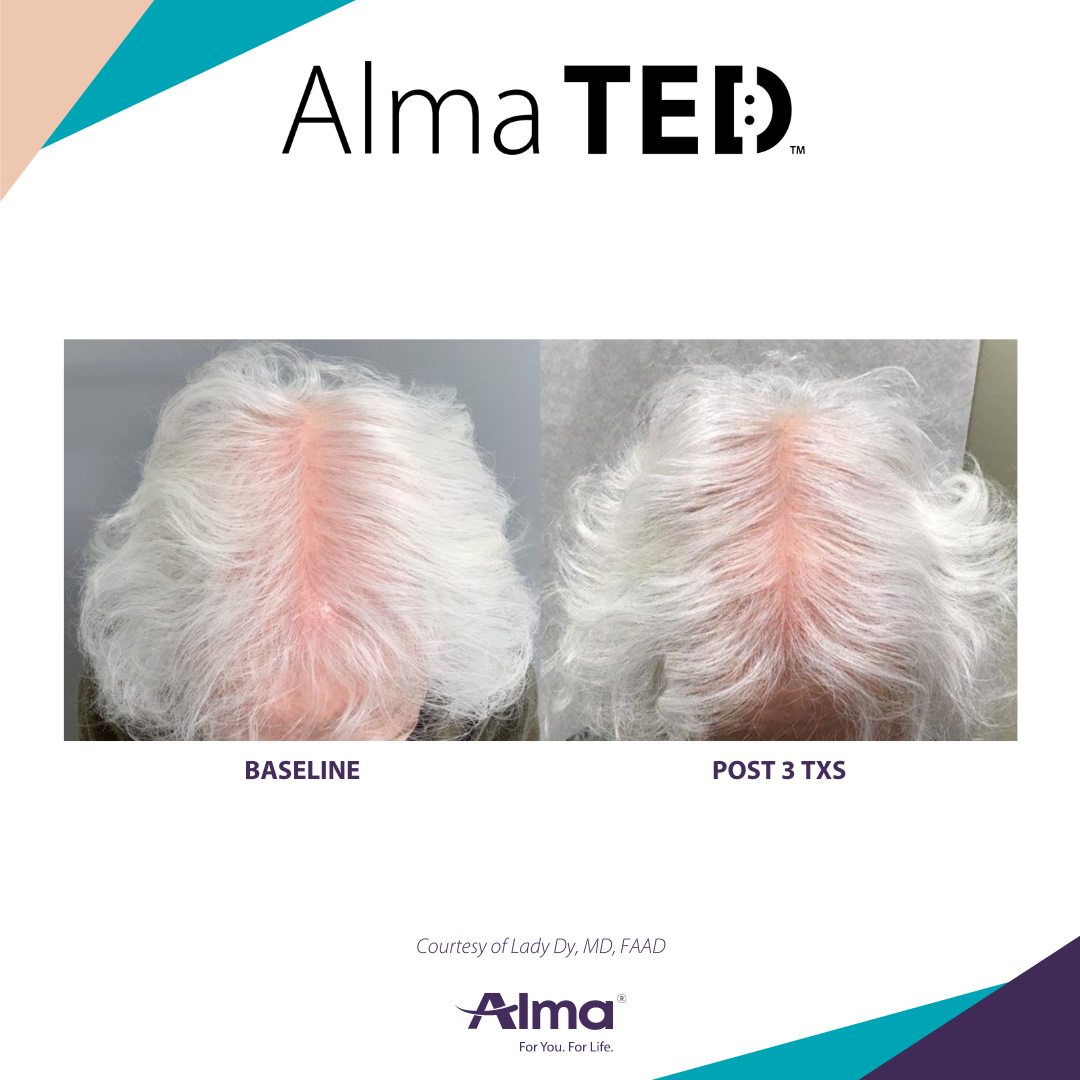 A before and after picture of a person 's hair