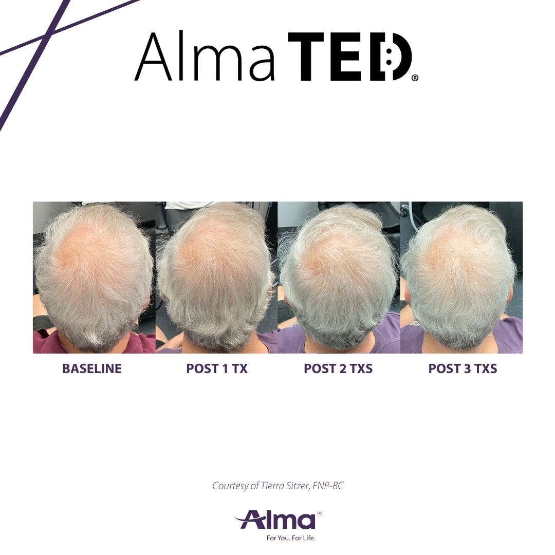 A before and after picture of a person 's hair
