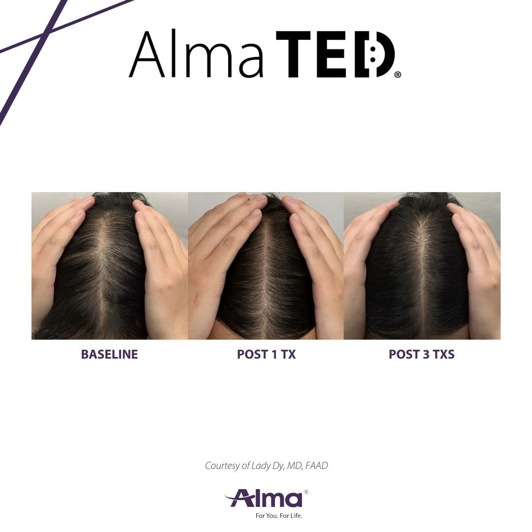A before and after picture of a woman 's hair