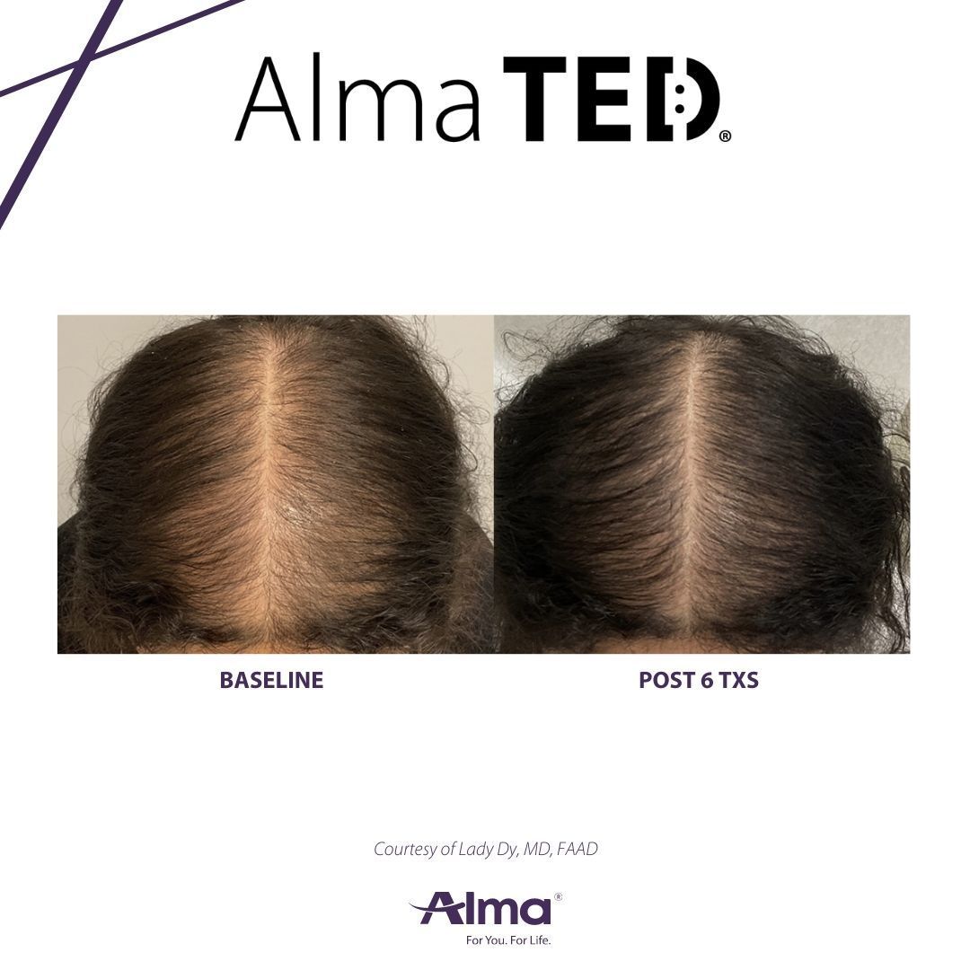 A before and after picture of a person 's hair