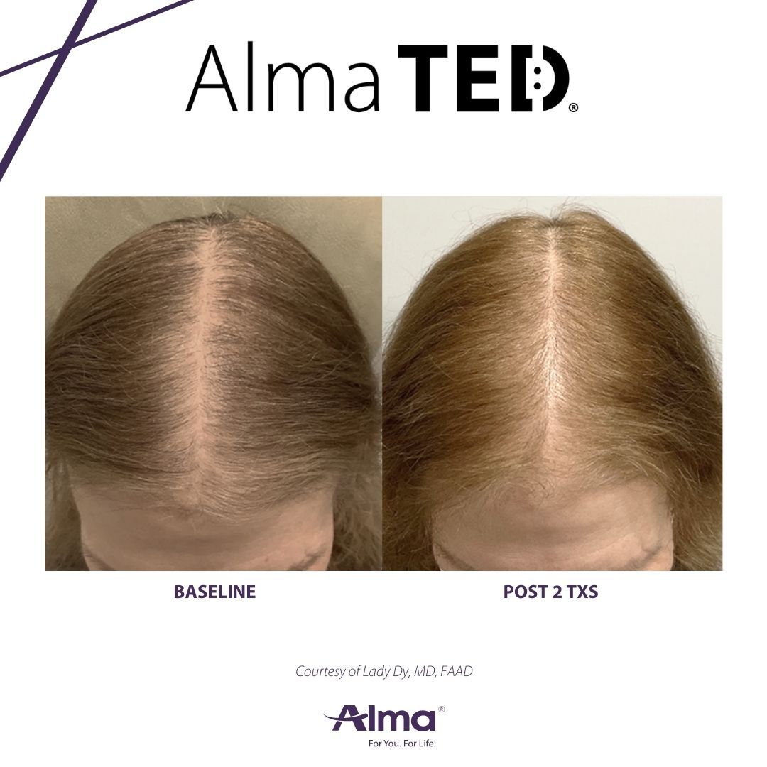 A before and after picture of a person 's hair