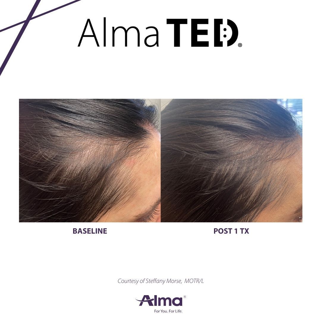 A before and after picture of a person 's hair