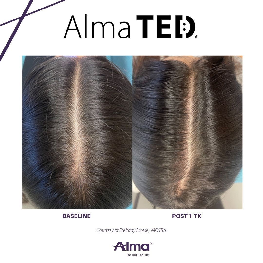 A before and after picture of a person 's hair