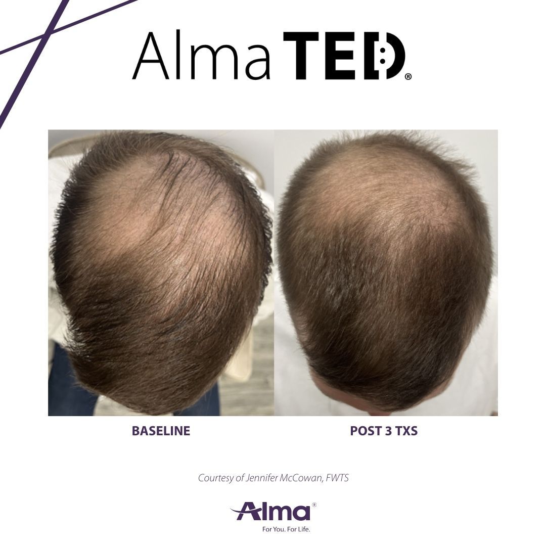 A before and after picture of a man 's hair