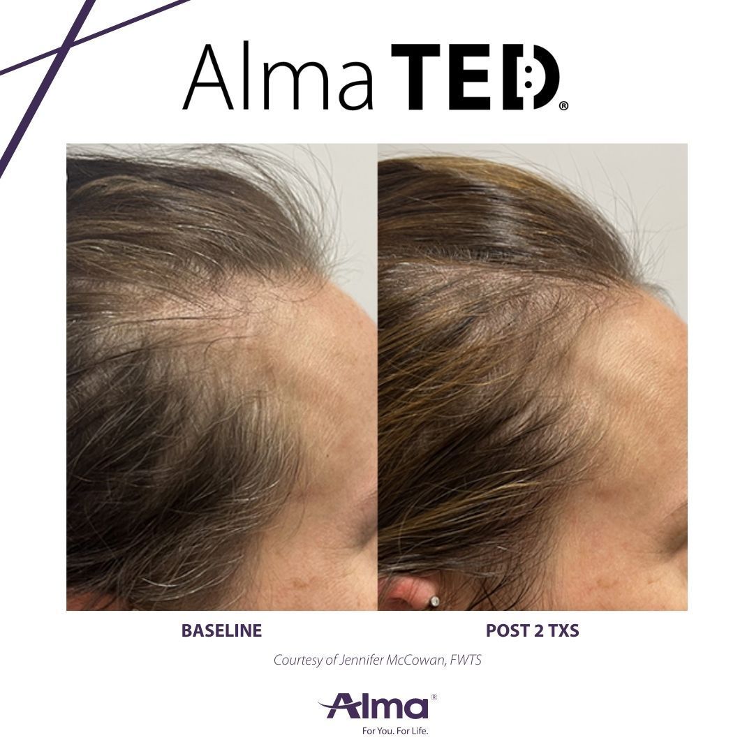 A before and after picture of a person 's hair
