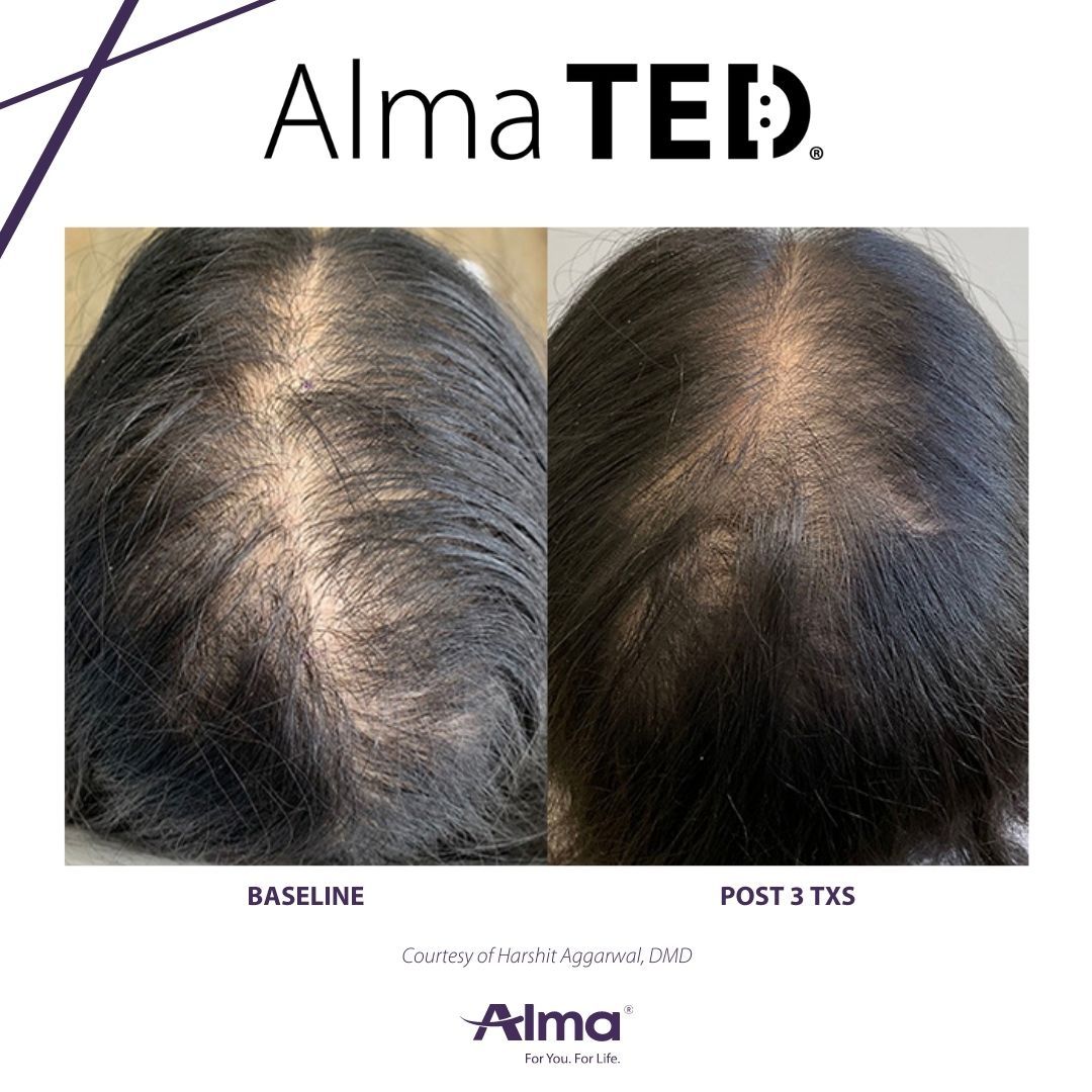 A before and after picture of a person 's hair